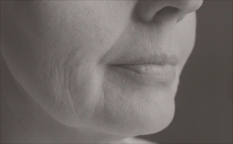 A detailed, black-and-white macro photograph of the lower half of a face, focusing on the mouth and cheek area. The image highlights natural skin texture and nasolabial folds (smile lines).