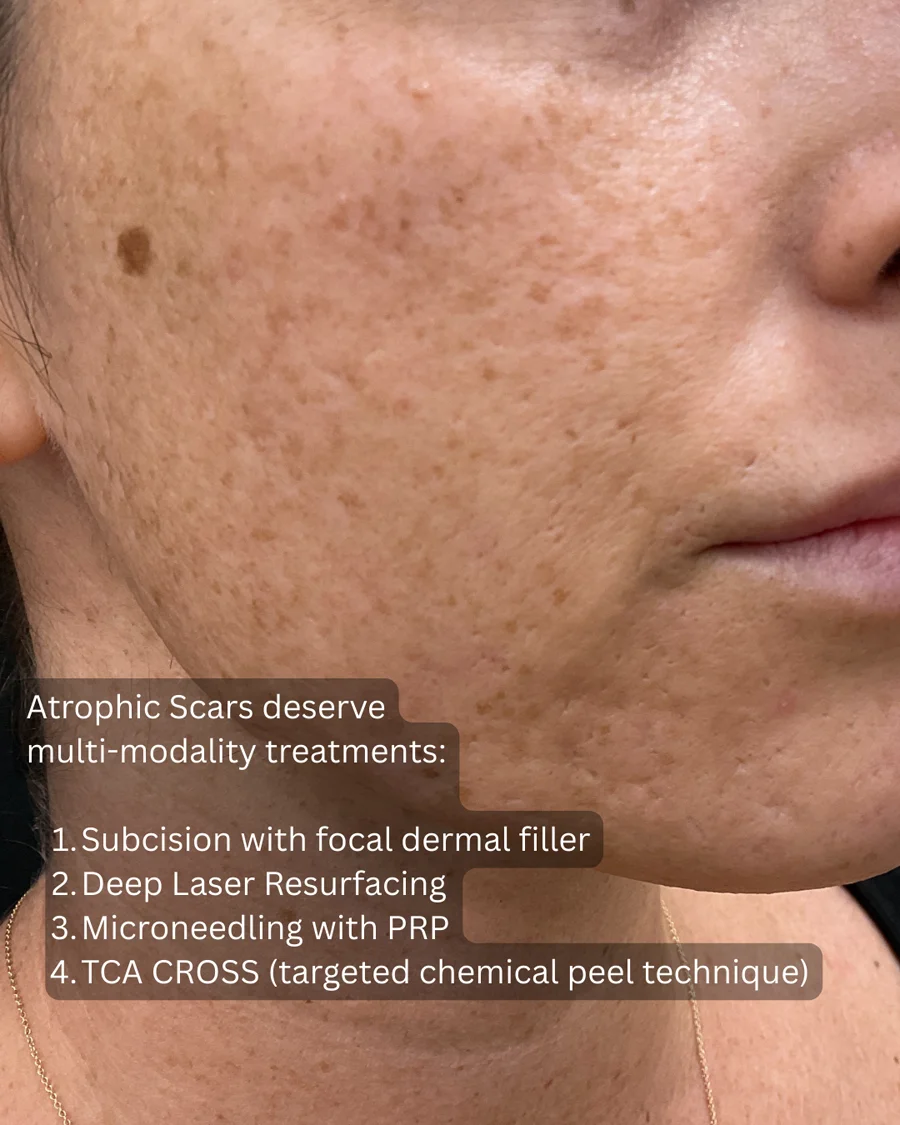 Before and after oculofacial plastic surgery results in Atlanta, GA, performed by Dr. Sahitya Reddy.